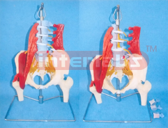 LUMBAR SPINE (PATHOLOGICAL CHANGES) WITH MUSCLES